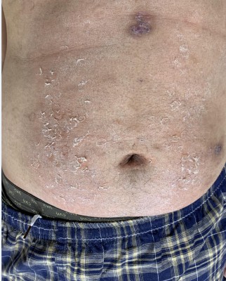 超细打磨的鞋跟大腿钻血洞，10和12厘米高跟跺肚子 YC-211012-3