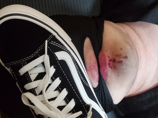 【橘子粥】脸部暴击，两双布鞋全体重踩头踩脸 YC-211119-3